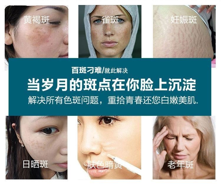 美白祛斑护肤品品牌的选择，探寻最佳方案，美白祛斑护肤品品牌探寻，最佳方案的选择