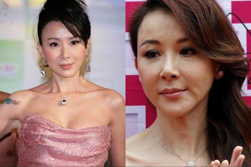 港台明星整容失败,探究背后的原因与教训,港台明星整容失败背后的原因与教训探究