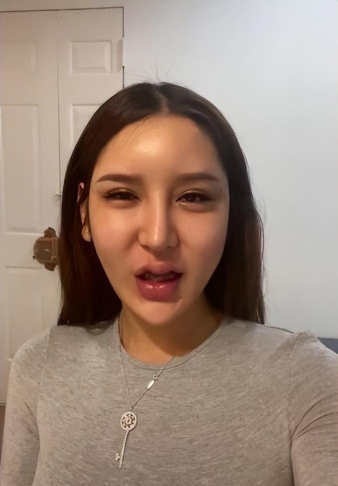 整容失败的脸，探索背后的故事与教训，整容失败背后的故事与教训探索